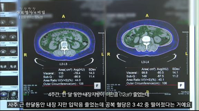 경희애문화 건강챙기기, 복부비만 줄이기 4주 프로젝트 놀라운 결과