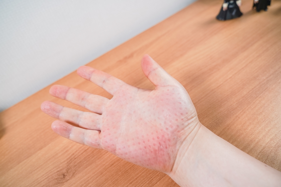 홈룸 손마사지기 추천, 손을 많이 쓴다면 꼭 필요한 손목안마기