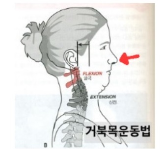 거북목 교정 스트레칭 서서 하는 맥켄지 운동 매일 해보세요