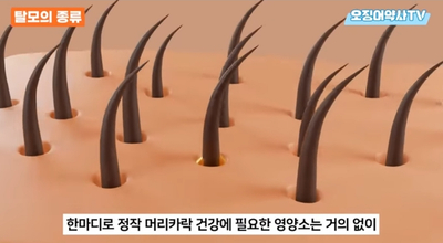 탈모 예방, 머리가 가늘고 힘이 없다면 이것부터 해보세요!