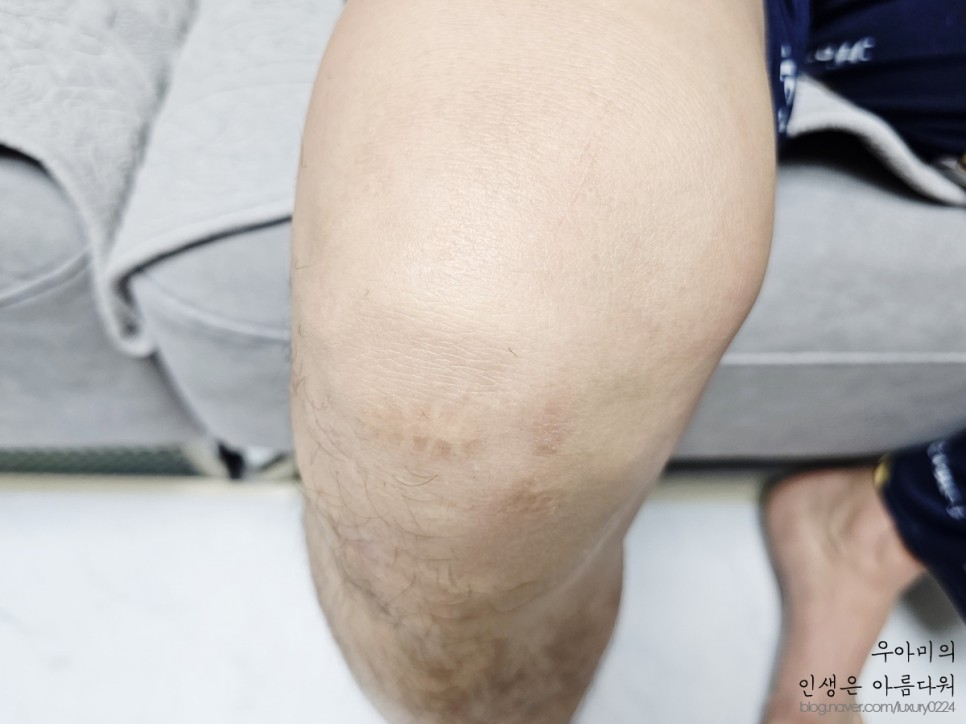 멜킨 무릎마사지기 추천, 온열기능부터 다리 어깨까지 관리해요!