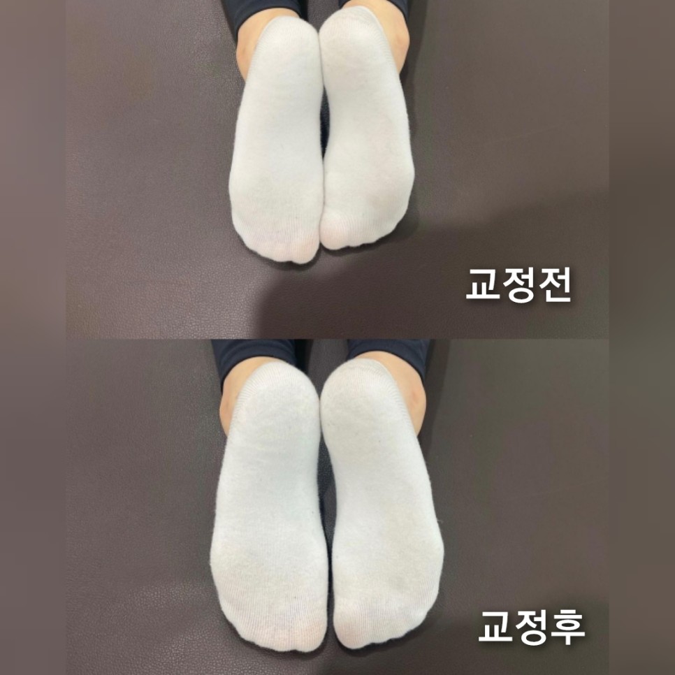 간석동필라테스 체형교정에 효과가 있나요