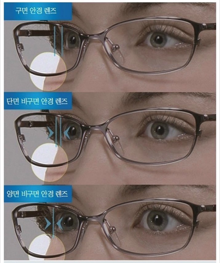 양면비구면렌즈 특징과 장단점 (구면렌즈, 비구면렌즈와 차이)