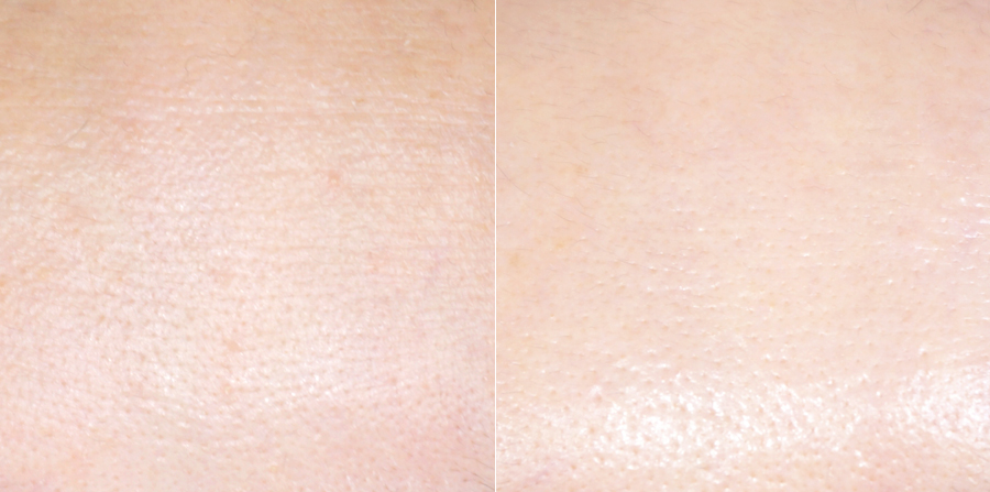 탄력크림 뷰티디바이스 추천, 피부리프팅 셀프 피부관리 방법