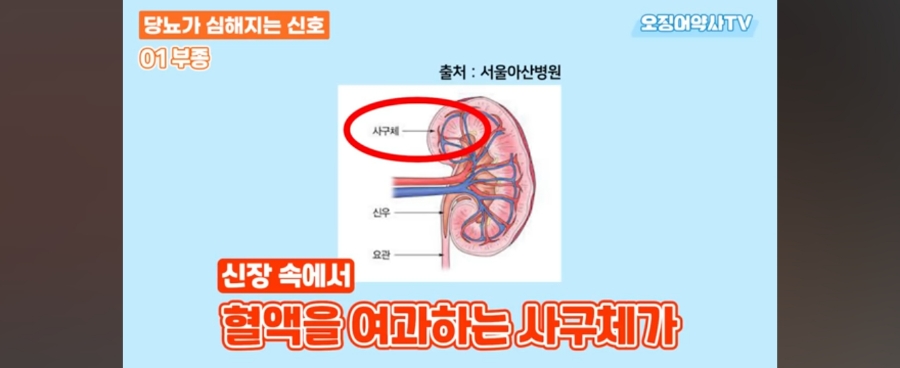 (오징어약사 TV )당뇨가  심해지고 있다는  강력한 신호들