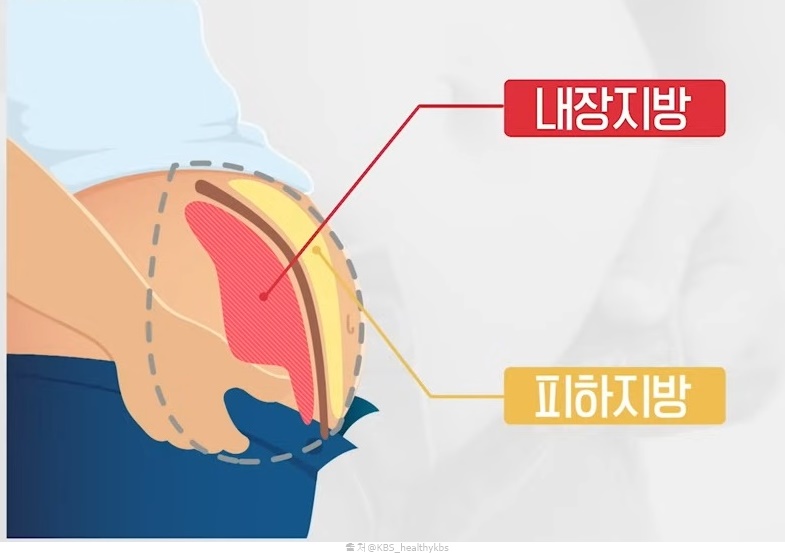 중년 남자 뱃살 내장지방 빼는 운동 플랭크 런지 자세 효과