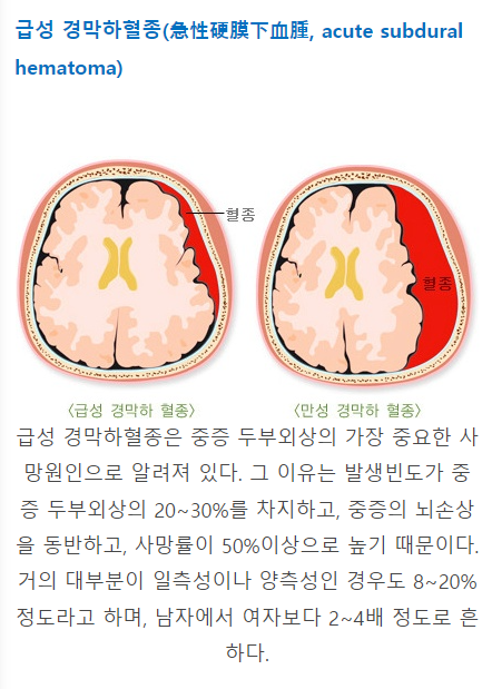 드래곤볼, 닥터 슬럼프 작가 토리야마 아키라 68세 급성 경막하혈종으로 사망