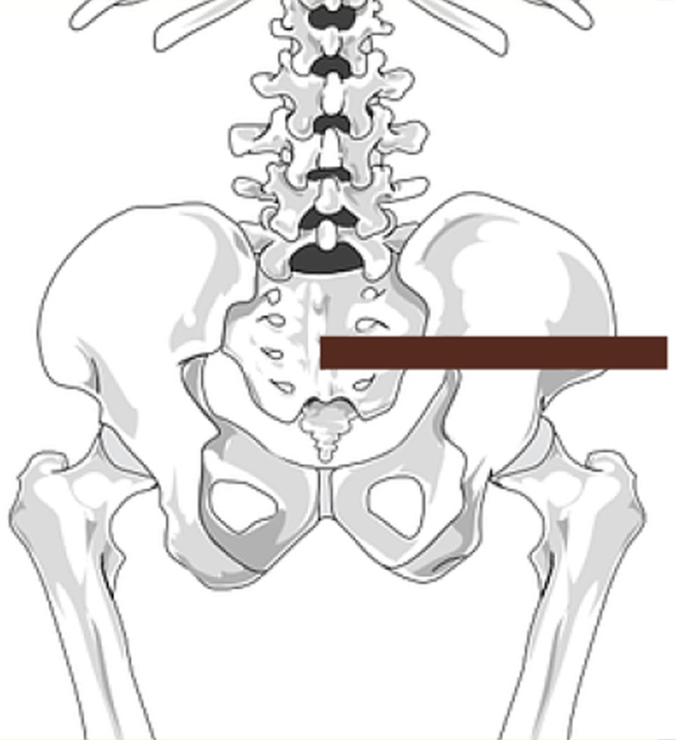 허리 통증 완화 방법 -  도수치료 마사지(엉덩이통증, 허리디스크, 척추기립근, 천골, 골반저근)