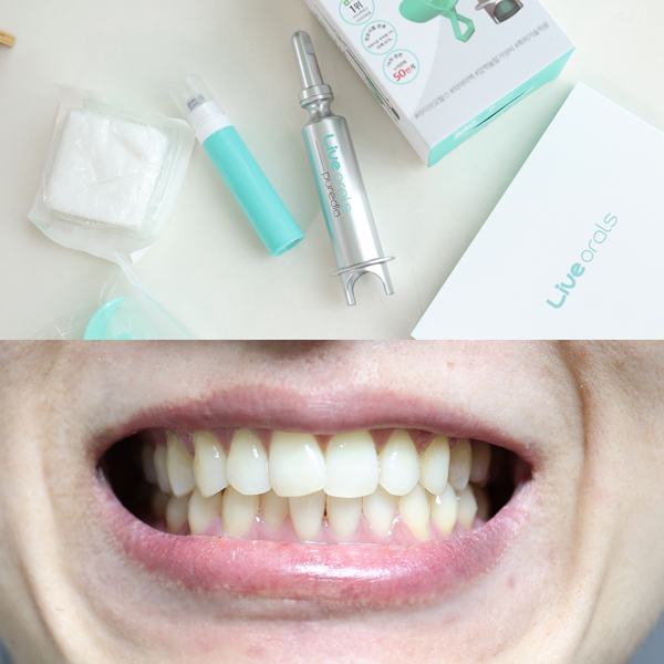 올리브영 셀프치아미백 치과의사가 개발한 라이브오랄스 사용법 후기
