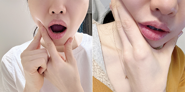 잇몸영양제 덴티시브 성분 4가지 확인