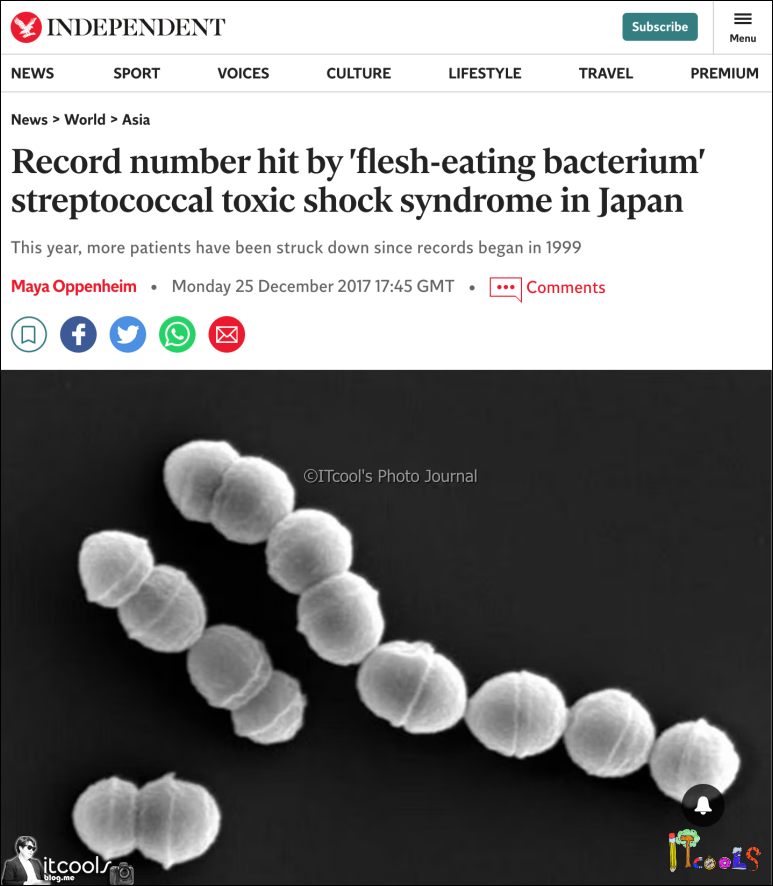 일본을 강타한 미스터리한 '살육균'의 확산: 독성 쇼크 증후군 확진 사례 급증