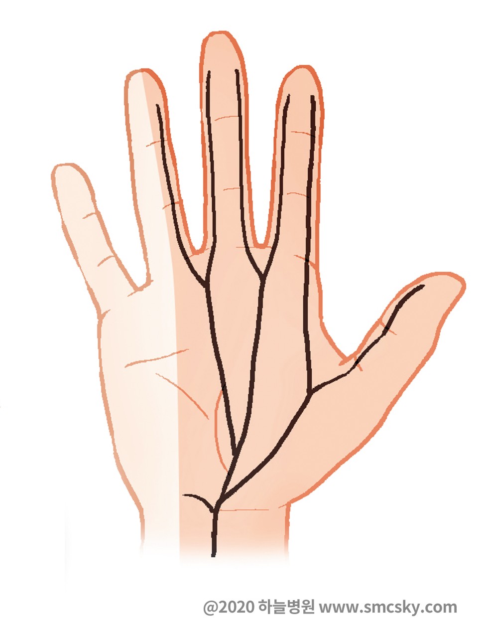 손저림 손목통증 원인은? 손목터널증후군 증상 및 스트레칭 테이핑 방법