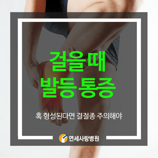 걸을때 발등 통증 나타난다면 결정종 의심해야