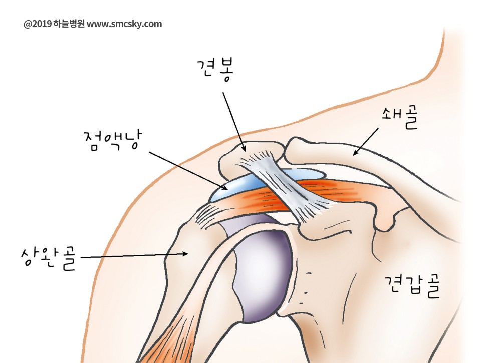 어깨 충돌증후군 증상 및 원인, 통증 치료 병원(재활 운동 및 스트레칭 방법)