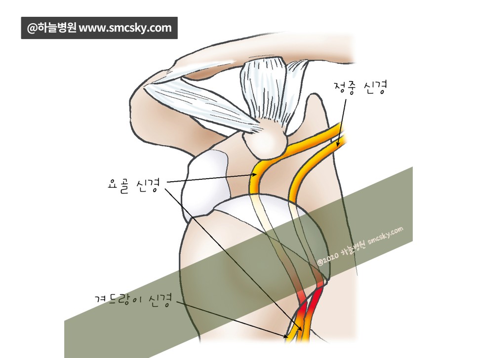 왼쪽, 오른쪽 어깨통증 원인 및 증상 질환(어깨가 아파요)