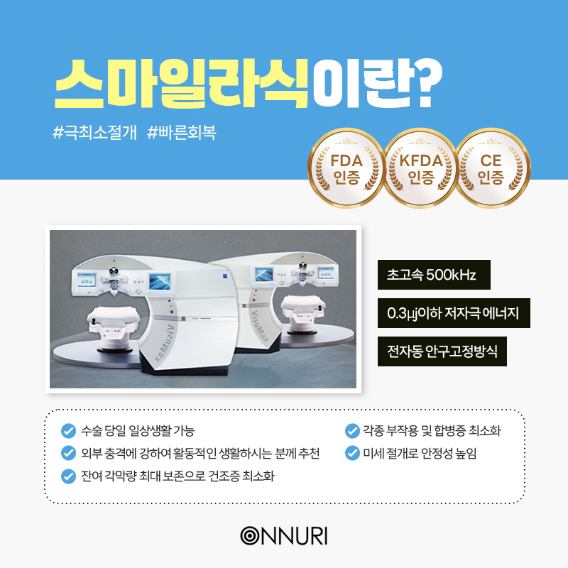 스마일라식 당일 회복 가능할까?
