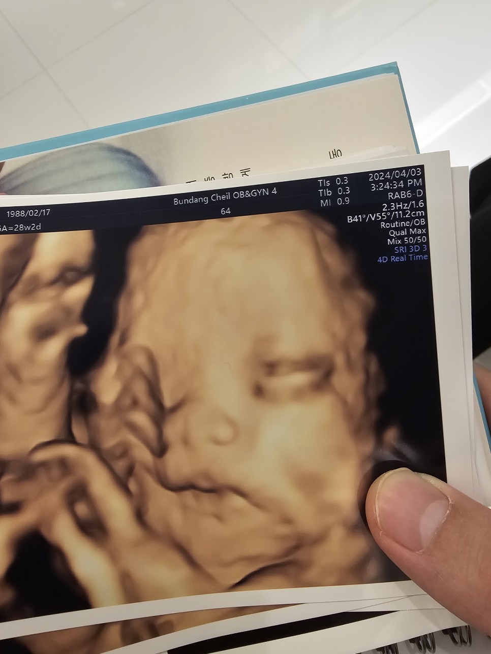 임신 28주 : 설렘 가득 입체초음파 ♥ 베이비페이스 추천코드 FTH2CYTD