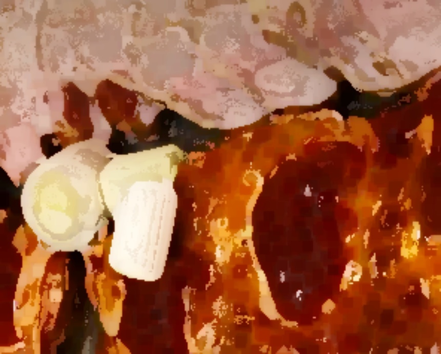 생생정보통 항아리바비큐 불주꾸미 식당 위치 대결맛대맛