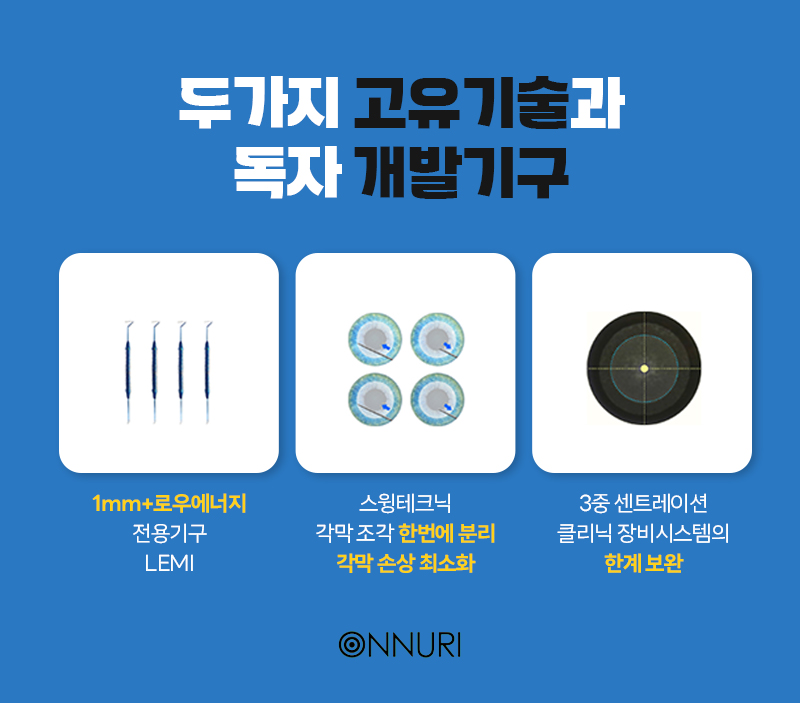 스마일라식 1mm각막 수술