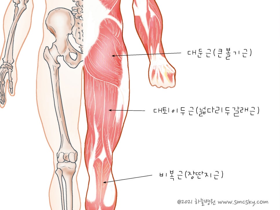 허벅지 뒤쪽 햄스트링 통증, 파열 증상 및 치료(운동 스트레칭 방법)