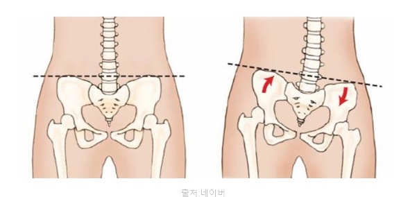 개구리자세 효과 하체부종요가동작 자세 교정 운동 요가 동작