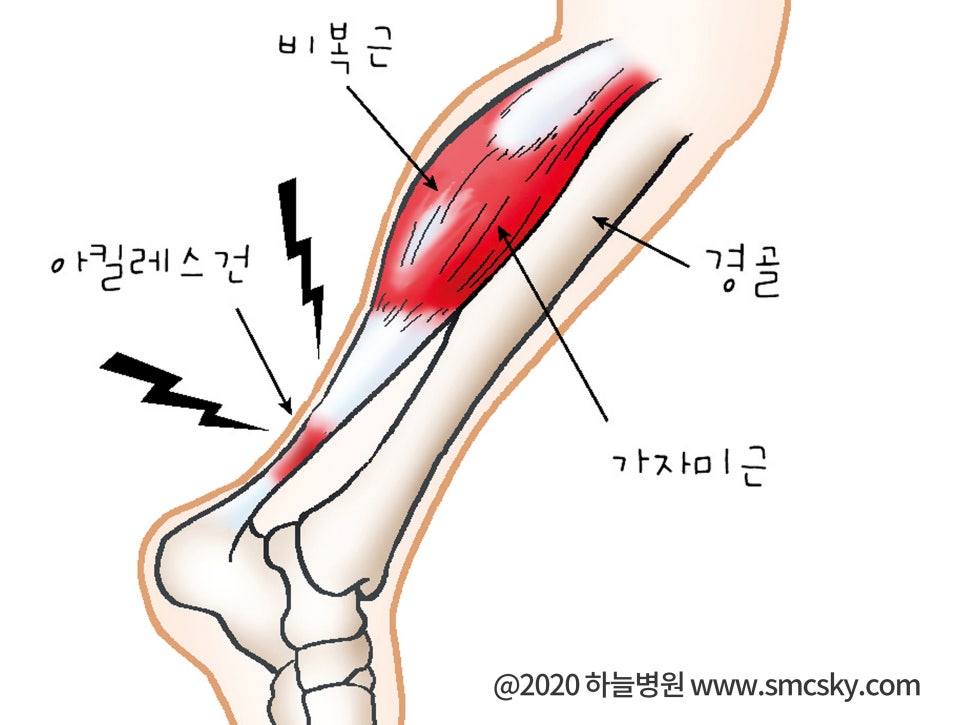 다리 쥐나는 이유 및 종아리 통증, 근육 뭉침(쥐났을때 마사지, 스트레칭 방법)