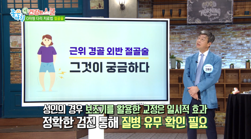 SBS 좋은아침 [더 건강한 스쿨] 고용곤, 정재현 연세사랑병원 의료진 중년 여성 관절염과 골다공증 예방 특강