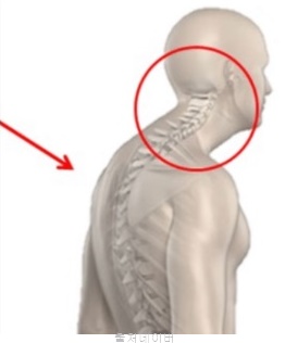 굽은등 교정 쉽게 하는 하부 승모근 운동 방법