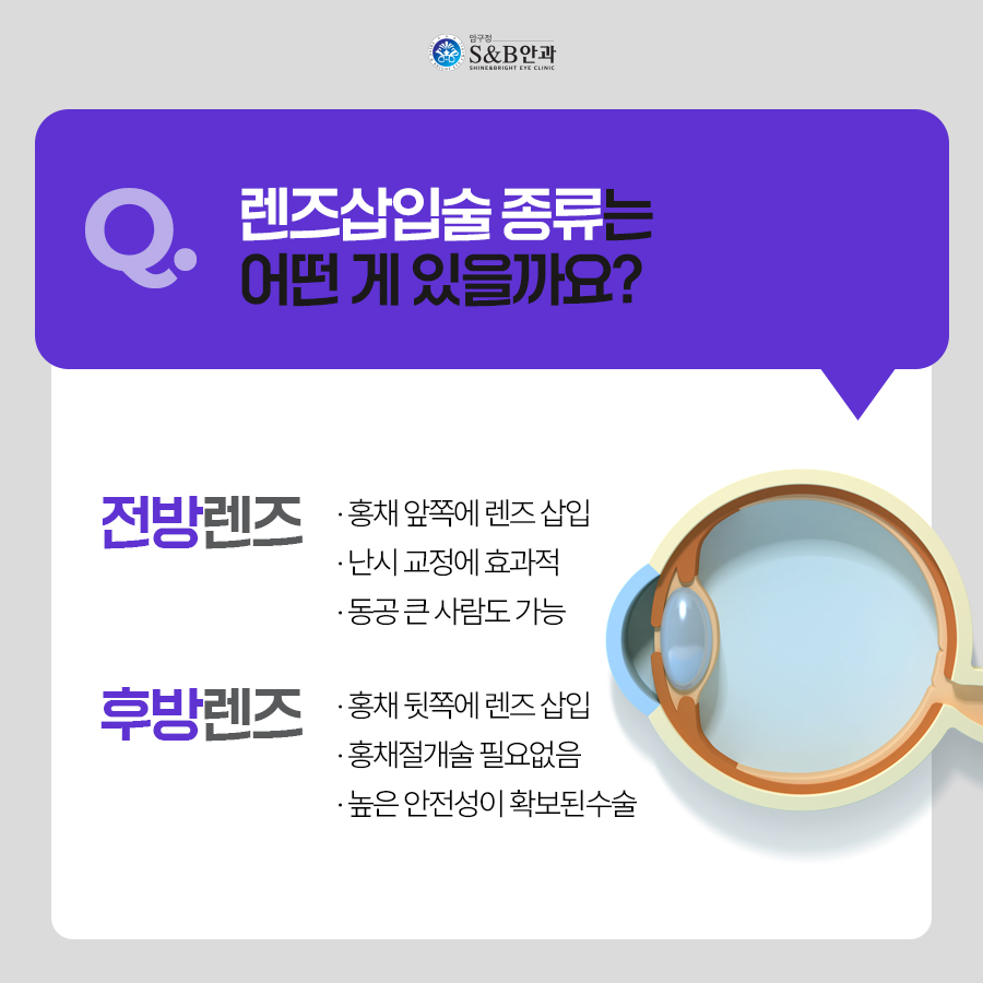 렌즈삽입술이 망설여진다면?