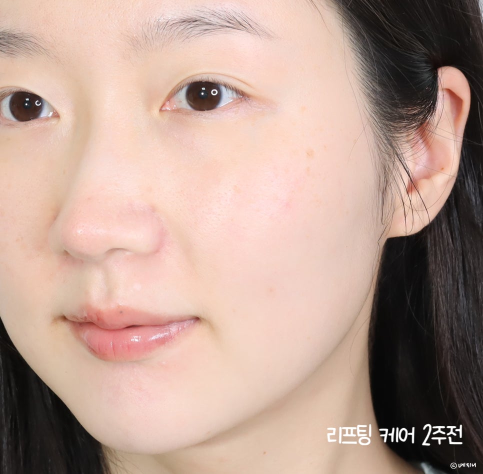 리프팅 케어 전후 관리법?! AP BEAUTY 듀얼 리페어 리프트 크림으로 2배 시너지 UP