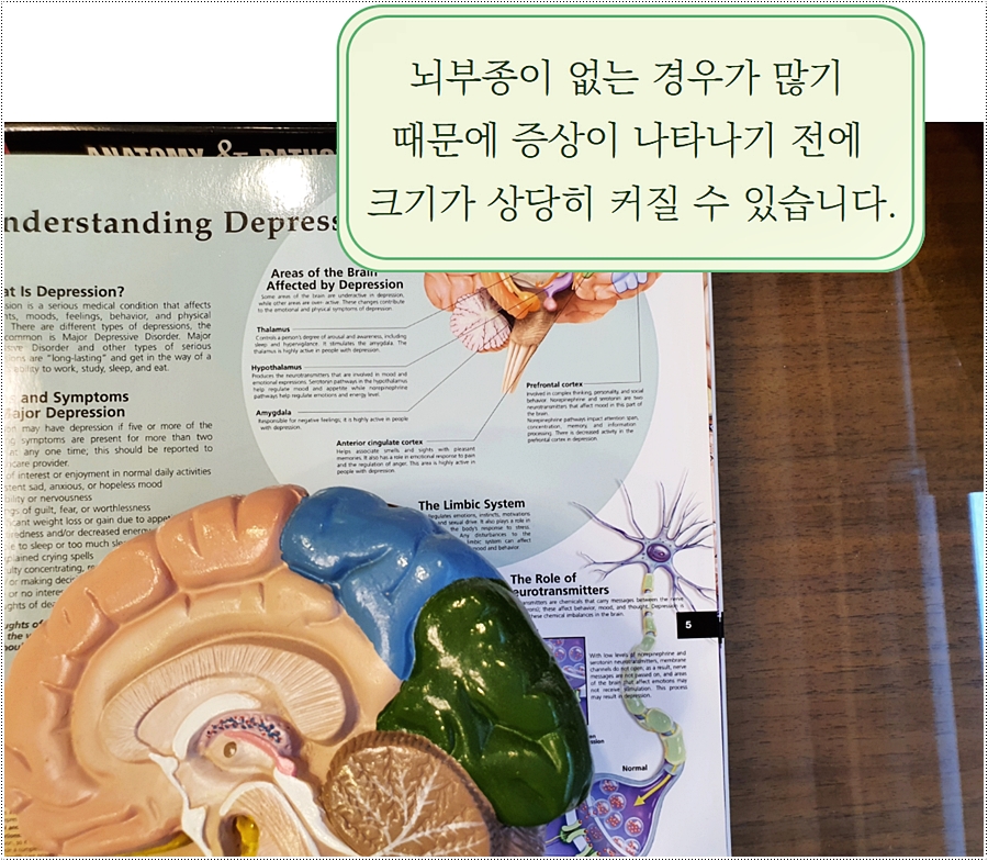 두개내종양 증상부터 진단은?