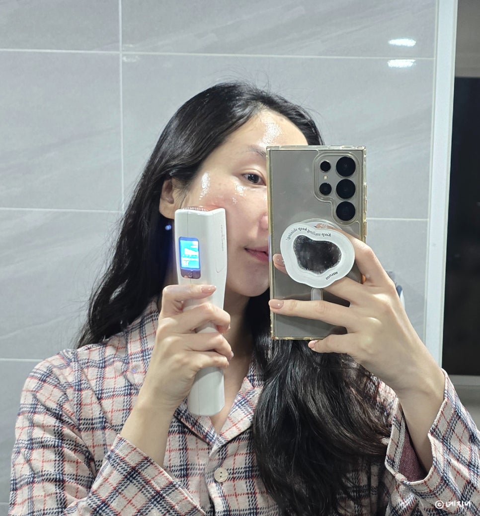 가정용울쎄라 브이라인 위해 써본 찐후기