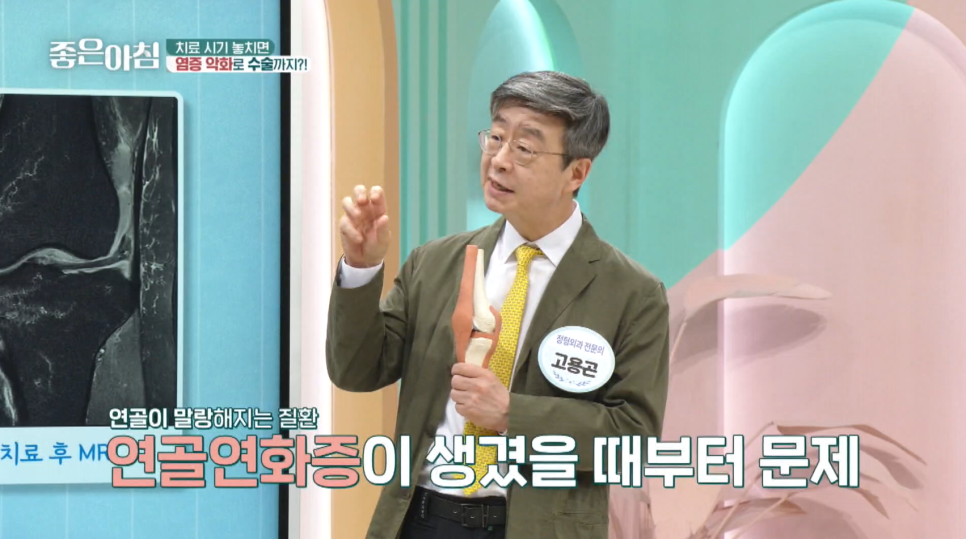 SBS 좋은아침 더 건강한 스쿨_손가락·무릎 관절염과 경추질환 특강(feat.연세사랑병원 고용곤X김성철)