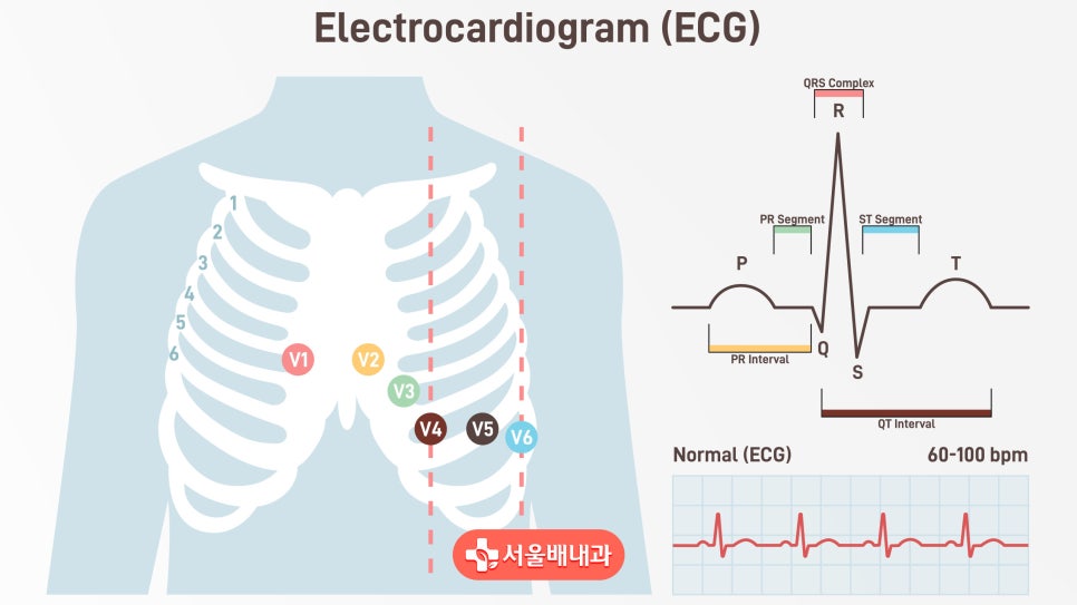 동성 서맥이란?