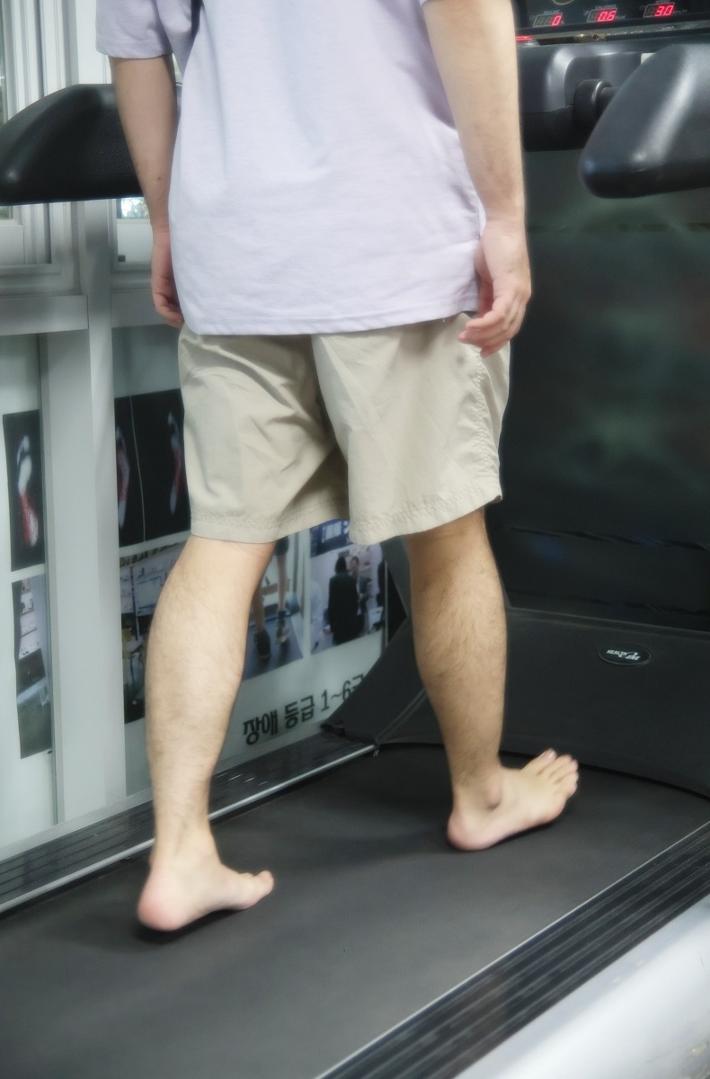 맞춤깔창 가격 제작 과정 후기 족저근막염 깔창