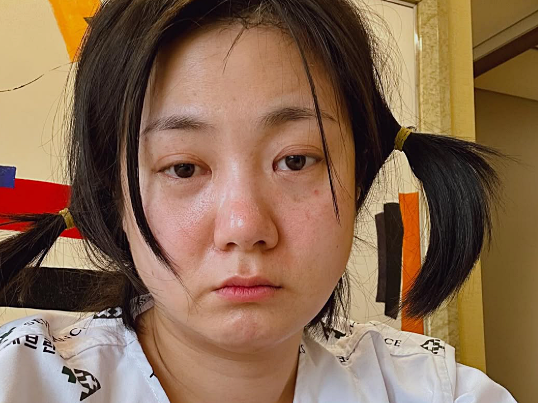 박나래 논란 핵심 정리: 1억 가압류부터 상해 주장까지 한눈에
