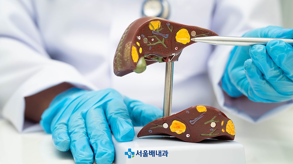 간수치 상승원인, 간기능검사